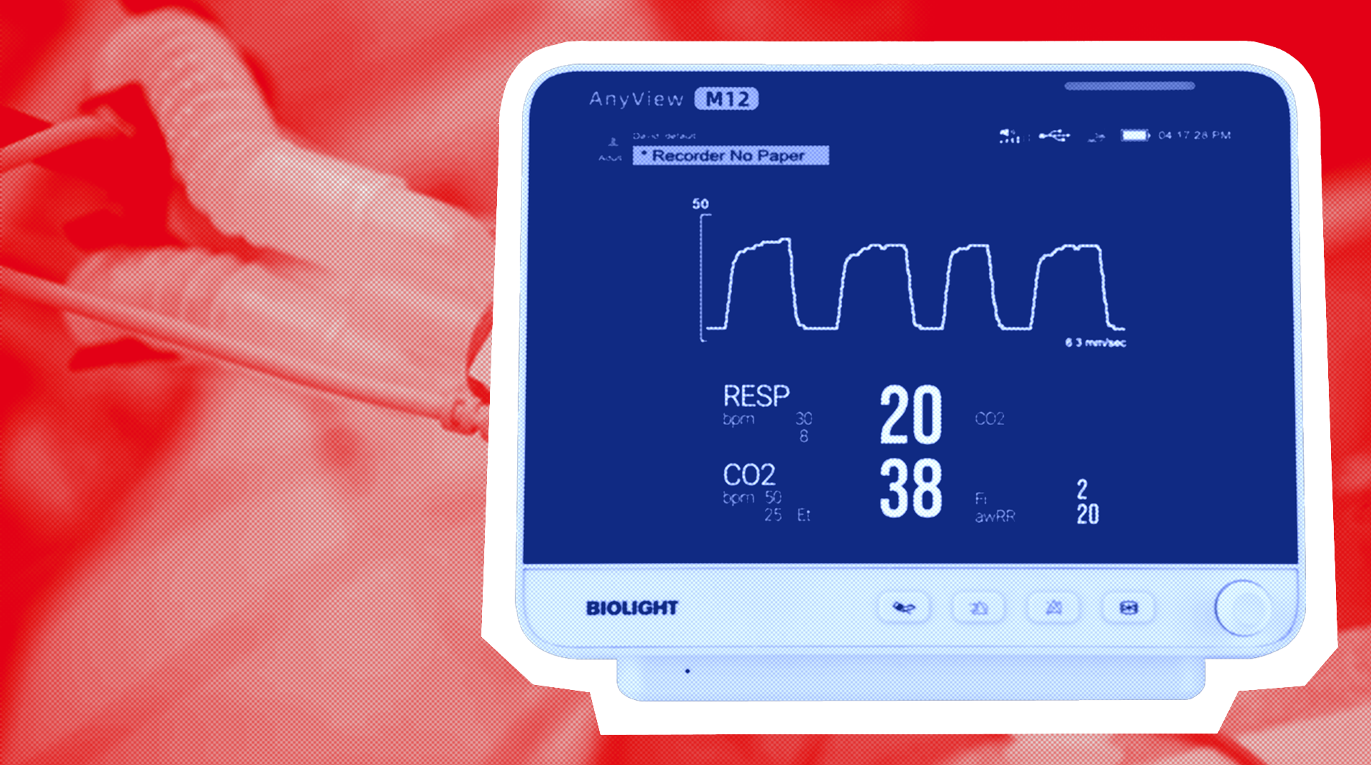 Мониторинг углекислого газа: виды капнографии, анализ капнограммы, типы капнографов