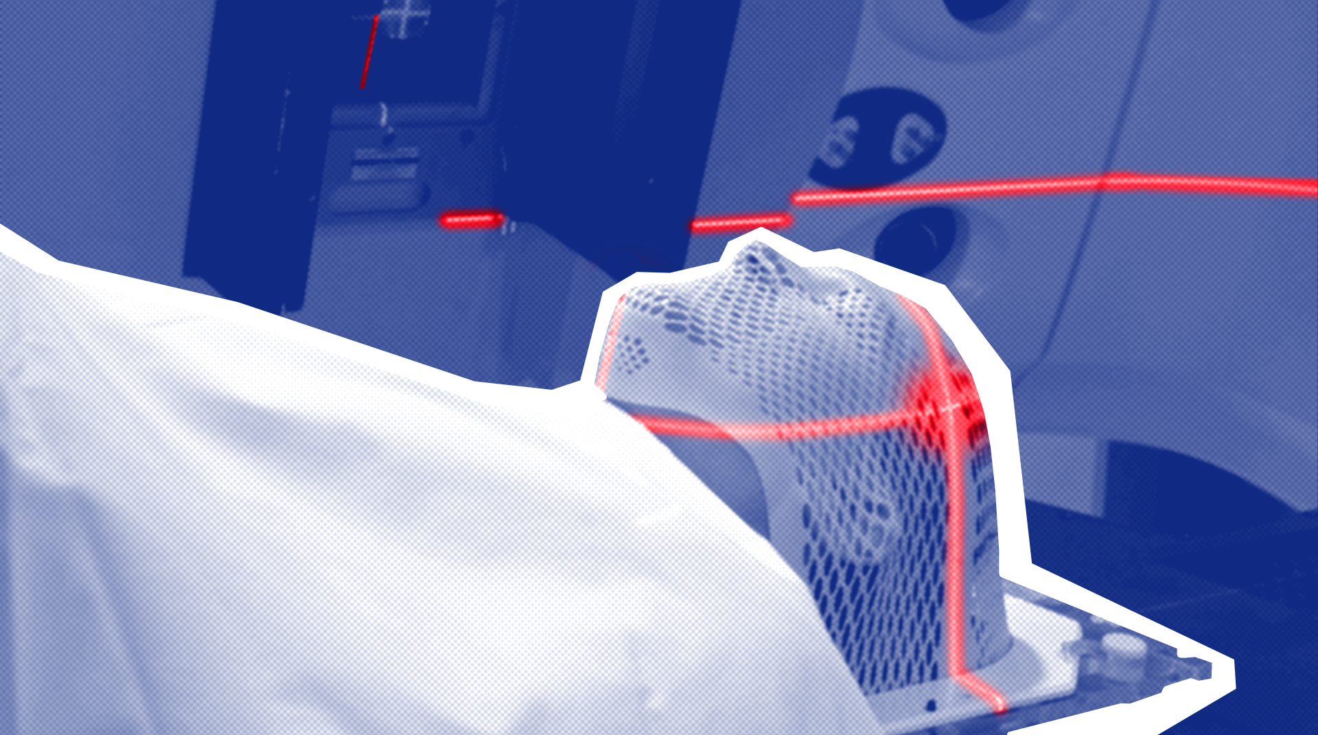 Лечение онкологии: методы облучения, виды лучевой терапии