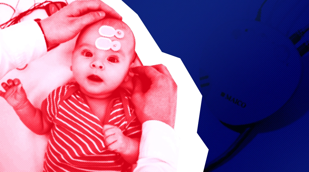 КСВП: полный гид по коротколатентным слуховым вызванным потенциалам